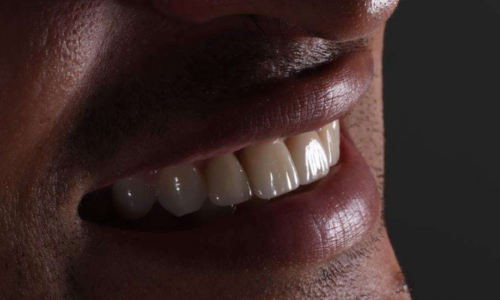 Dental Case