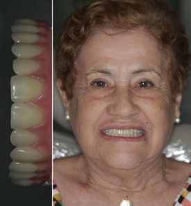 Dental Patient 1 Dental Patient
